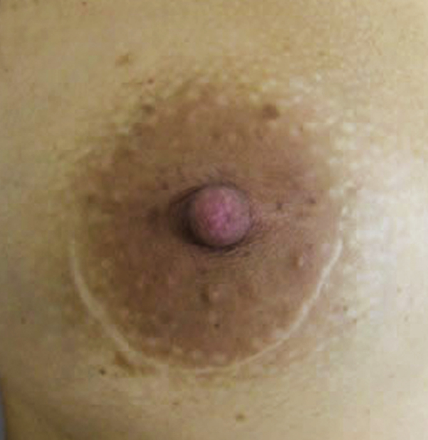 Image link