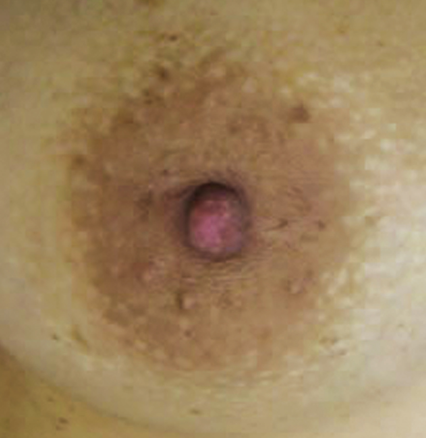Image link